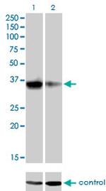 GSC Antibody in Western Blot (WB)