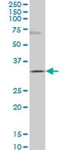 GSC Antibody in Western Blot (WB)