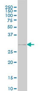 GSC Antibody in Western Blot (WB)