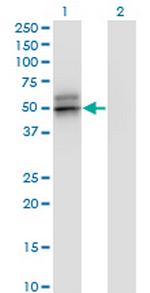 SERPINA12 Antibody in Western Blot (WB)