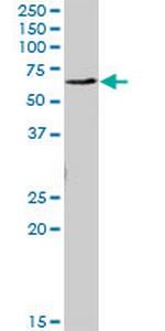 EME1 Antibody in Western Blot (WB)