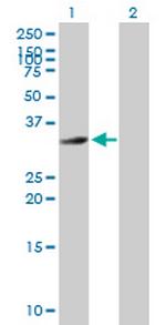 HFE2 Antibody in Western Blot (WB)