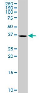 HFE2 Antibody in Western Blot (WB)