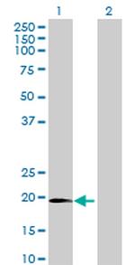 C1ORF84 Antibody in Western Blot (WB)