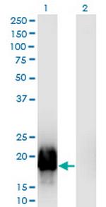 GTSF1L Antibody in Western Blot (WB)