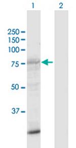 SIK1 Antibody in Western Blot (WB)