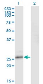 NFAM1 Antibody in Western Blot (WB)