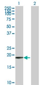 COMMD1 Antibody in Western Blot (WB)