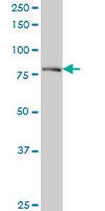 DTX3L Antibody in Western Blot (WB)