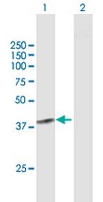 SGOL1 Antibody in Western Blot (WB)