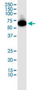 SGOL1 Antibody in Western Blot (WB)