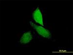 CNKSR3 Antibody in Immunocytochemistry (ICC/IF)