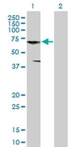 CNKSR3 Antibody in Western Blot (WB)