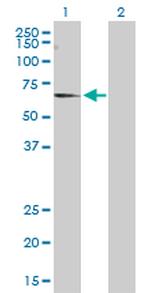 CNKSR3 Antibody in Western Blot (WB)