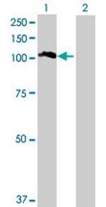 TTC16 Antibody in Western Blot (WB)