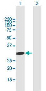 ADAL Antibody in Western Blot (WB)