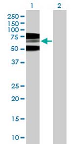 RNF168 Antibody in Western Blot (WB)