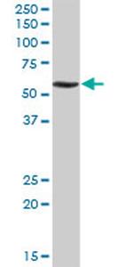 RNF168 Antibody in Western Blot (WB)