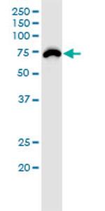 RNF168 Antibody in Western Blot (WB)