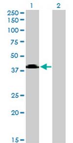 SGMS2 Antibody in Western Blot (WB)