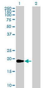 LIX1 Antibody in Western Blot (WB)