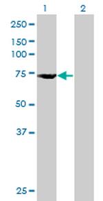 DDX53 Antibody in Western Blot (WB)