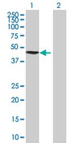 ZNF596 Antibody in Western Blot (WB)