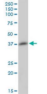 MGC17403 Antibody in Western Blot (WB)