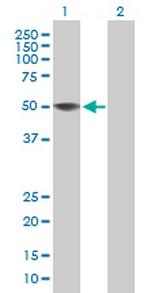 ZCCHC12 Antibody in Western Blot (WB)