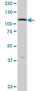 ADAMTS17 Antibody in Western Blot (WB)