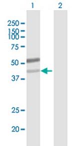 B3Gn-T6 Antibody in Western Blot (WB)