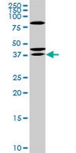 RDHE2 Antibody in Western Blot (WB)
