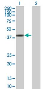 CCDC131 Antibody in Western Blot (WB)