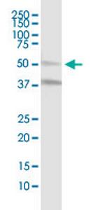 MLKL Antibody in Western Blot (WB)