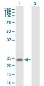 U2AF1L4 Antibody in Western Blot (WB)