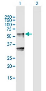 LIPH Antibody in Western Blot (WB)