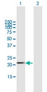 DHFRL1 Antibody in Western Blot (WB)