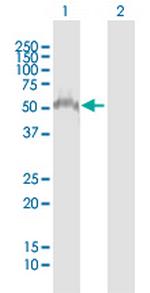 ZSCAN4 Antibody in Western Blot (WB)