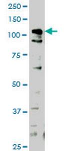 HIPK1 Antibody in Western Blot (WB)