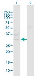 C10orf63 Antibody in Western Blot (WB)