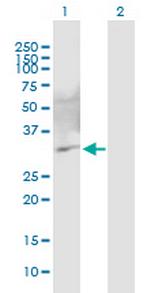 C10orf63 Antibody in Western Blot (WB)