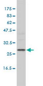 DEPC-1 Antibody in Western Blot (WB)