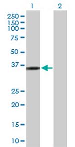 KIF6 Antibody in Western Blot (WB)