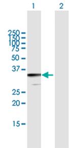 JAZF1 Antibody in Western Blot (WB)