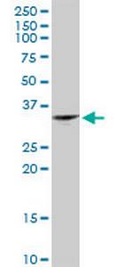 JAZF1 Antibody in Western Blot (WB)