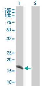 ATXN7L4 Antibody in Western Blot (WB)