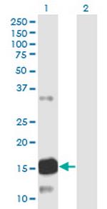 ATXN7L1 Antibody in Western Blot (WB)