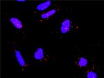 RICTOR Antibody in Proximity Ligation Assay (PLA) (PLA)