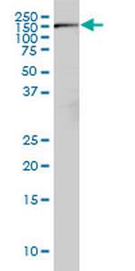 RICTOR Antibody in Western Blot (WB)