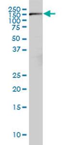 RICTOR Antibody in Western Blot (WB)